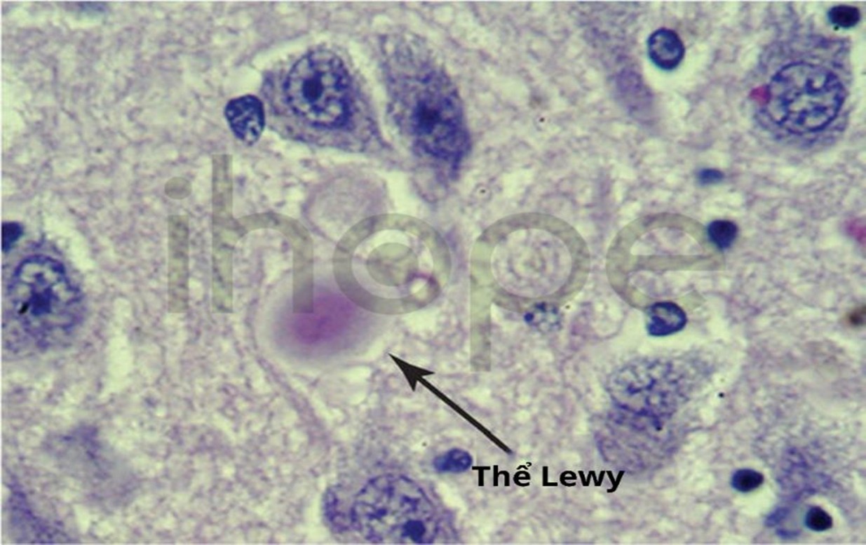 Picture1